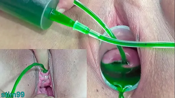 مقاطع فيديو ضخمة Cervix and Pee Hole Inflation with Injections for Japanese Lesbians ضخمة